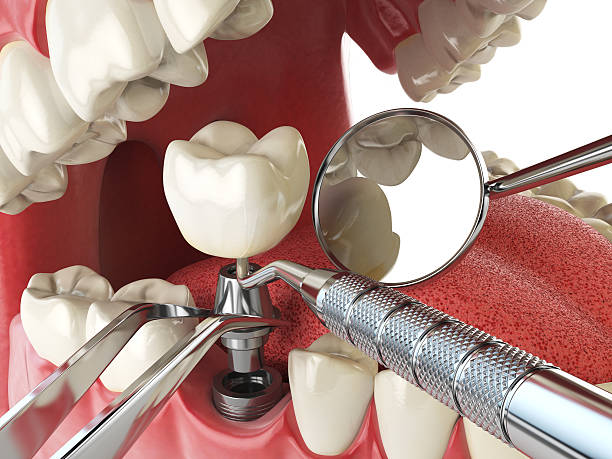 Best Orthodontic Emergency Dentist in Mission Hills, CA